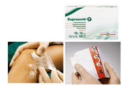 MEDICAZIONE STERILE IN FILM IN POLIURETANO TRASP. SUPRASORB F 10X12CM 10 PEZZI - Farmacia De Pasquale